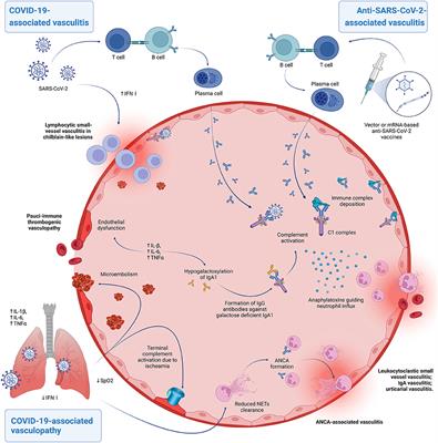 Cutaneous vasculitis and vasculopathy in the era of COVID-19 pandemic